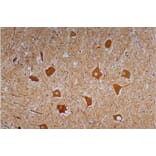 Immunohistochemistry - Anti-Neurofilament H Antibody [NF-01] (A85596) - Antibodies.com