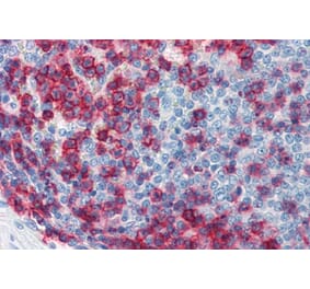 Immunohistochemistry - Anti-CD43 Antibody [MEM-59] (A85599) - Antibodies.com