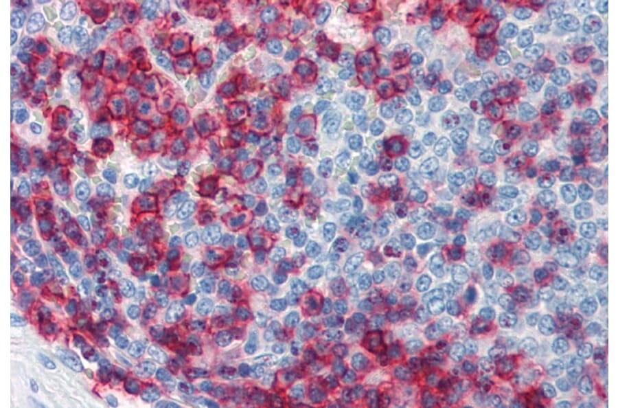 Immunohistochemistry - Anti-CD43 Antibody [MEM-59] (A85599) - Antibodies.com