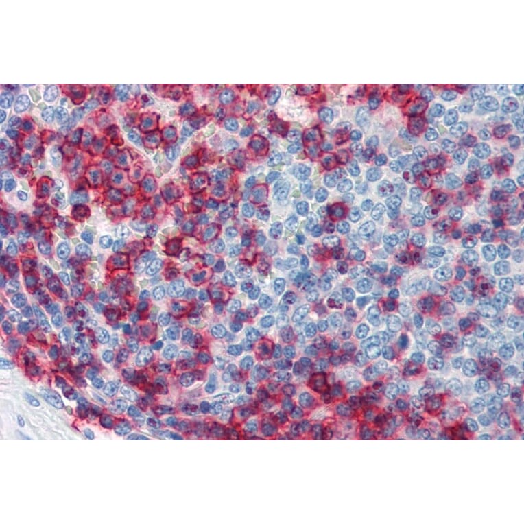 Immunohistochemistry - Anti-CD43 Antibody [MEM-59] (A85599) - Antibodies.com