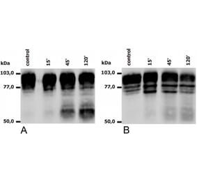 WB - Anti-CD18 Antibody [MEM-148] (A85610)