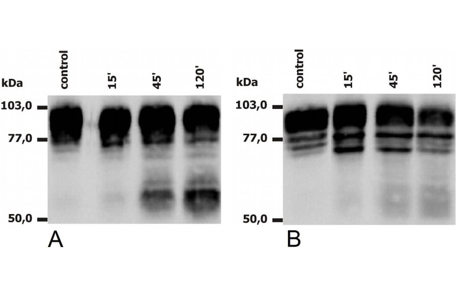 WB - Anti-CD18 Antibody [MEM-148] (A85610)
