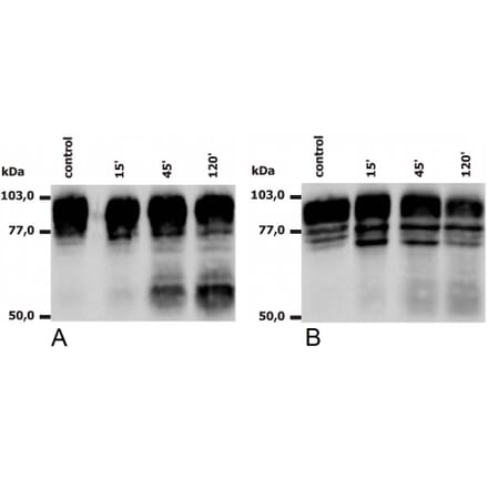 WB - Anti-CD18 Antibody [MEM-148] (A85610)