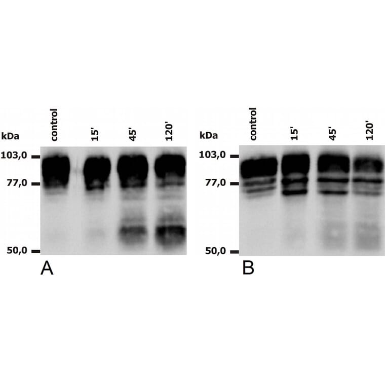 WB - Anti-CD18 Antibody [MEM-148] (A85610)