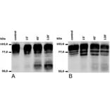 WB - Anti-CD18 Antibody [MEM-148] (A85610)