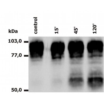 Western Blot - Anti-CD18 Antibody [MEM-148] (A85610) - Antibodies.com