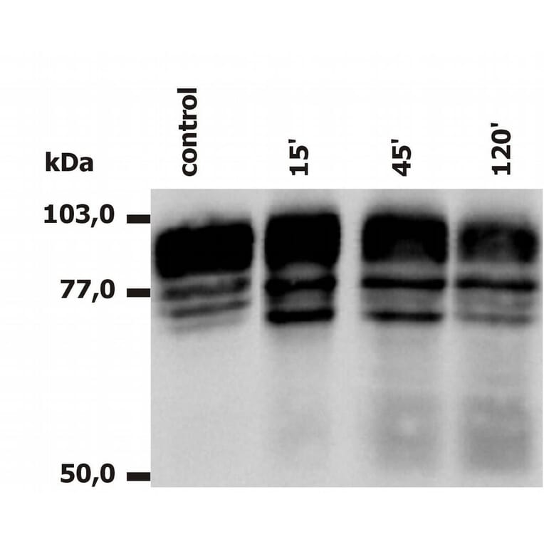 Western Blot - Anti-CD18 Antibody [MEM-148] (A85609) - Antibodies.com