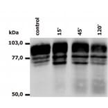 Western Blot - Anti-CD18 Antibody [MEM-148] (A85609) - Antibodies.com