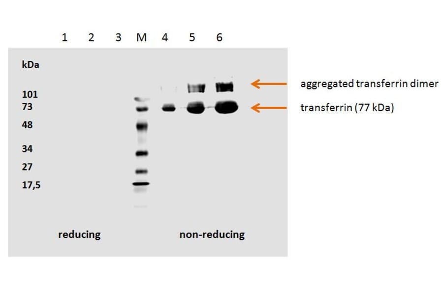 Western Blot - Anti-Transferrin Antibody [HTF-14] (A85618) - Antibodies.com