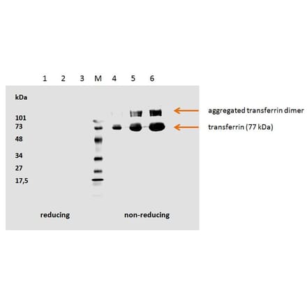 Western Blot - Anti-Transferrin Antibody [HTF-14] (A85618) - Antibodies.com