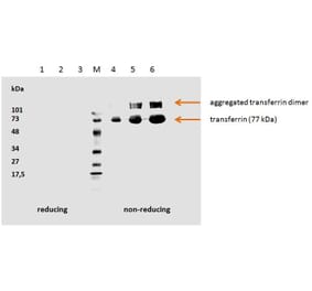 WB - Anti-Transferrin Antibody [HTF-14] - BSA and Azide free (A85623)