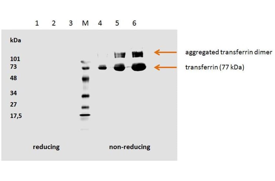 WB - Anti-Transferrin Antibody [HTF-14] - BSA and Azide free (A85623)