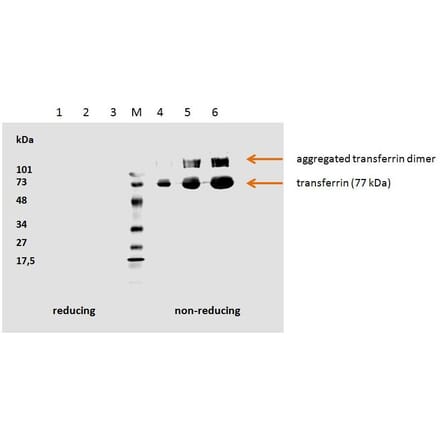 WB - Anti-Transferrin Antibody [HTF-14] - BSA and Azide free (A85623)