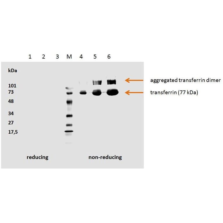 WB - Anti-Transferrin Antibody [HTF-14] - BSA and Azide free (A85623)