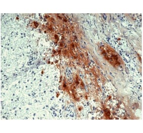 IHC - Anti-beta Endorphin Antibody [B31.15] (A85629)