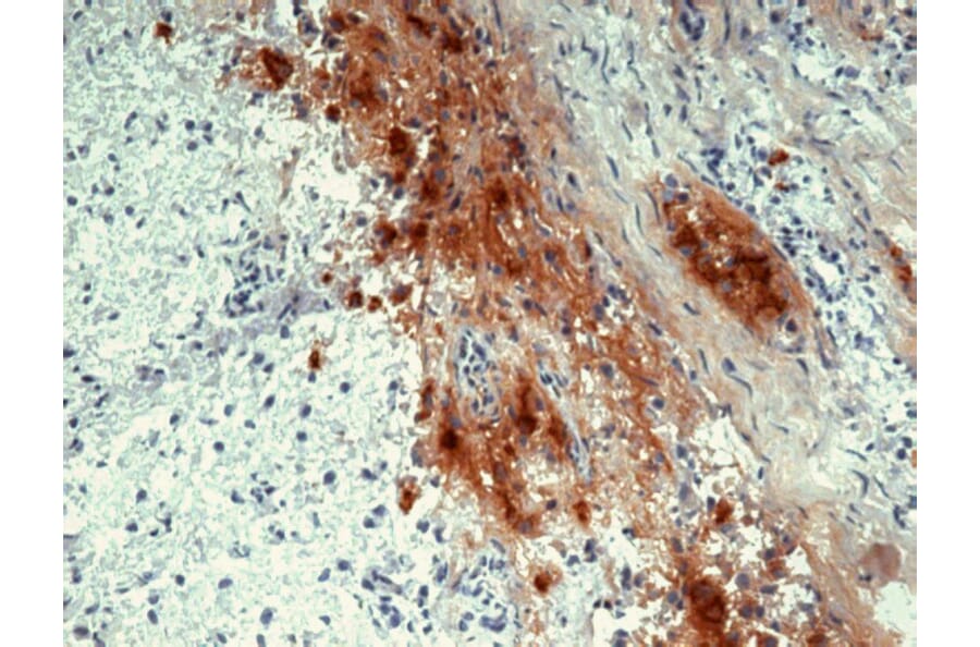 Immunohistochemistry - Anti-beta Endorphin Antibody [B31.15] (A85628) - Antibodies.com