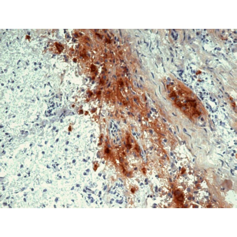 Immunohistochemistry - Anti-beta Endorphin Antibody [B31.15] (A85628) - Antibodies.com