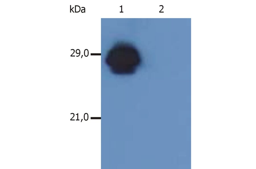 Western Blot - Anti-HLA DR + HLA DP Antibody [MEM-136] (A85630) - Antibodies.com