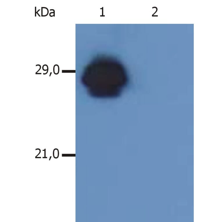 Western Blot - Anti-HLA DR + HLA DP Antibody [MEM-136] (A85630) - Antibodies.com