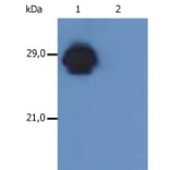 Western Blot - Anti-HLA DR + HLA DP Antibody [MEM-136] (A85630) - Antibodies.com