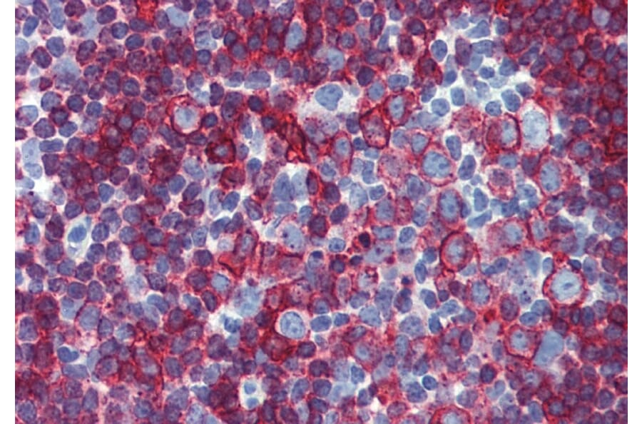Immunohistochemistry - Anti-HLA DR + HLA DP Antibody [MEM-136] (A85629) - Antibodies.com