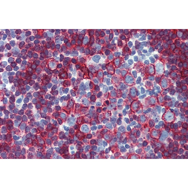 Immunohistochemistry - Anti-HLA DR + HLA DP Antibody [MEM-136] (A85629) - Antibodies.com
