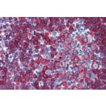 Immunohistochemistry - Anti-HLA DR + HLA DP Antibody [MEM-136] (A85629) - Antibodies.com