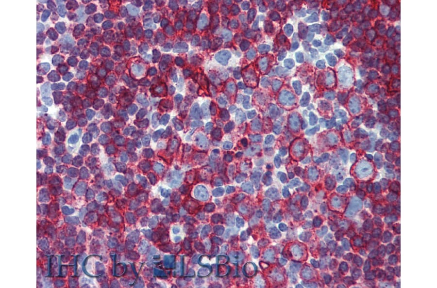 IHC - Anti-HLA DR + HLA DP Antibody [MEM-136] (A85630)