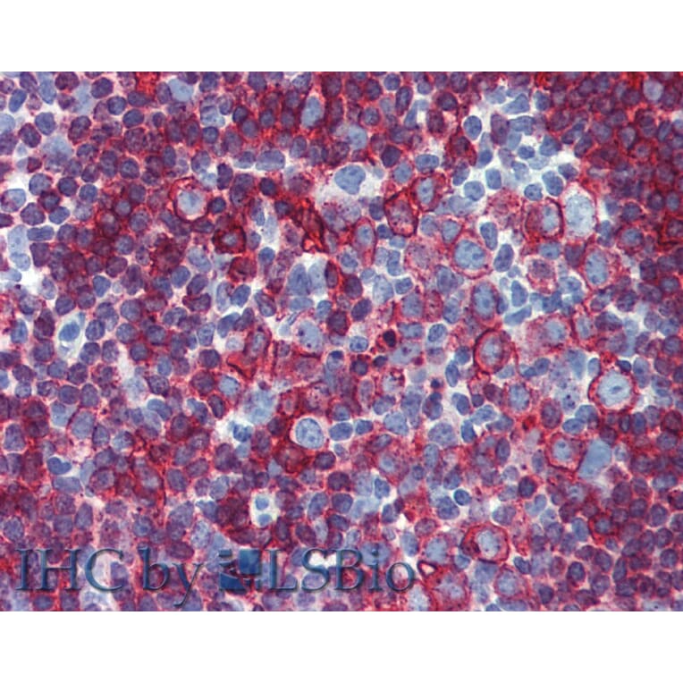 IHC - Anti-HLA DR + HLA DP Antibody [MEM-136] (A85630)