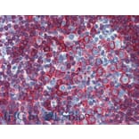 IHC - Anti-HLA DR + HLA DP Antibody [MEM-136] (A85630)