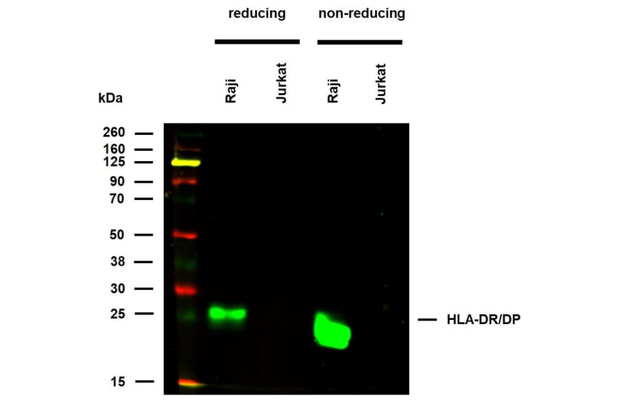 WB - Anti-HLA DR + HLA DP Antibody [MEM-136] (A85630)