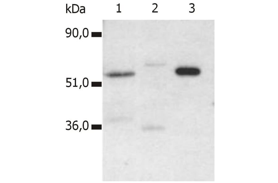 IP - Anti-CD4 Antibody [MEM-115] (A85638)