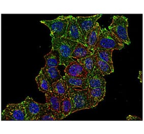 ICC - Anti-Transferrin Receptor Antibody [MEM-75] (A85654)