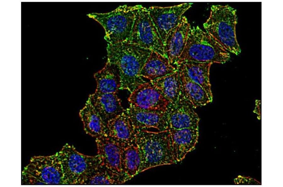 ICC - Anti-Transferrin Receptor Antibody [MEM-75] (A85654)