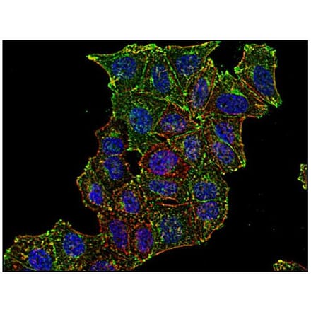 ICC - Anti-Transferrin Receptor Antibody [MEM-75] (A85654)