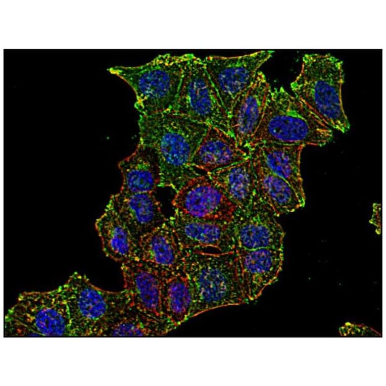 ICC - Anti-Transferrin Receptor Antibody [MEM-75] (A85654)