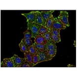 ICC - Anti-Transferrin Receptor Antibody [MEM-75] (A85654)