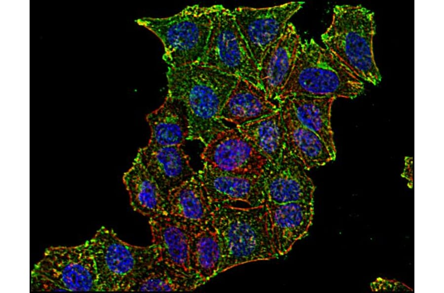 Immunocytochemistry - Anti-CD71 Antibody [MEM-75] (A85652) - Antibodies.com