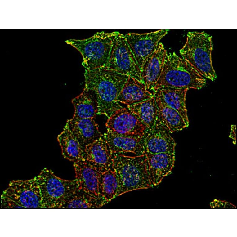 Immunocytochemistry - Anti-CD71 Antibody [MEM-75] (A85652) - Antibodies.com