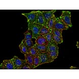 Immunocytochemistry - Anti-CD71 Antibody [MEM-75] (A85652) - Antibodies.com