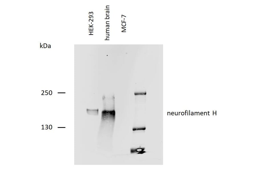 WB - Anti-Neurofilament H Antibody [NF-05] (A85669)