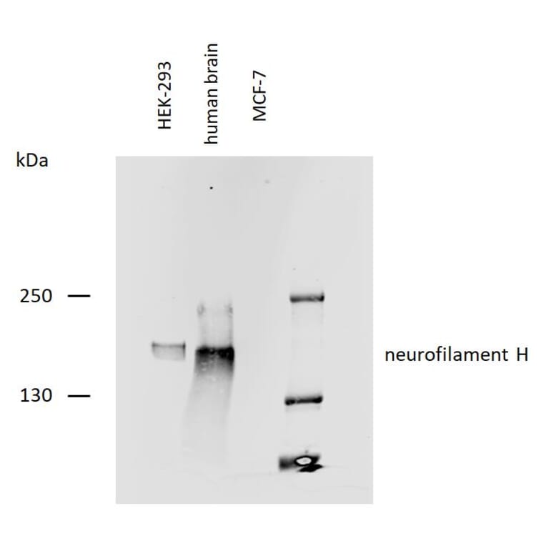 WB - Anti-Neurofilament H Antibody [NF-05] (A85669)