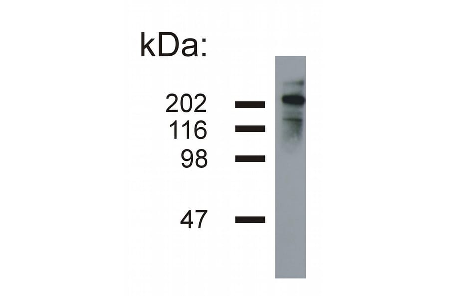 Western Blot - Anti-Neurofilament H Antibody [NF-05] (A85668) - Antibodies.com