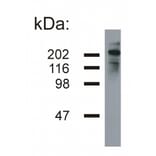 Western Blot - Anti-Neurofilament H Antibody [NF-05] (A85668) - Antibodies.com