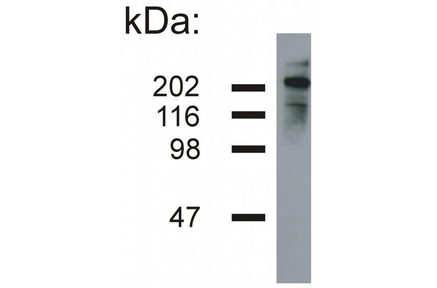 WB - Anti-Neurofilament H Antibody [NF-05] (A85669)