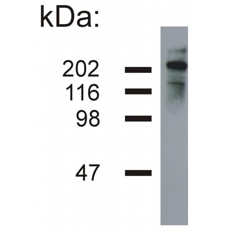 WB - Anti-Neurofilament H Antibody [NF-05] (A85669)