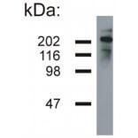 WB - Anti-Neurofilament H Antibody [NF-05] (A85669)