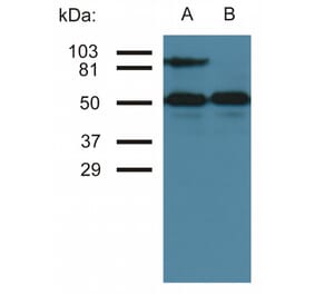 Western Blot - Anti-ICAM1 Antibody [MEM-111] (A85681) - Antibodies.com