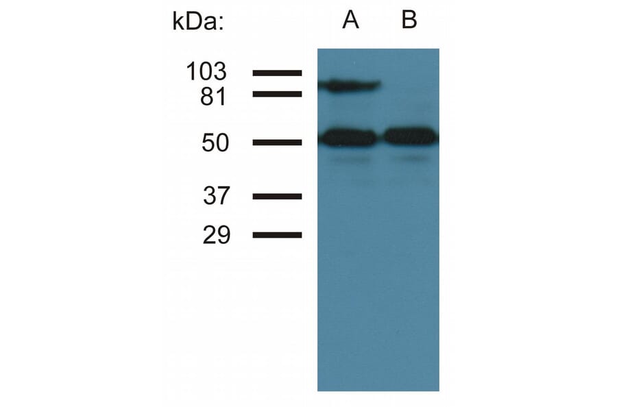 Western Blot - Anti-ICAM1 Antibody [MEM-111] (A85681) - Antibodies.com