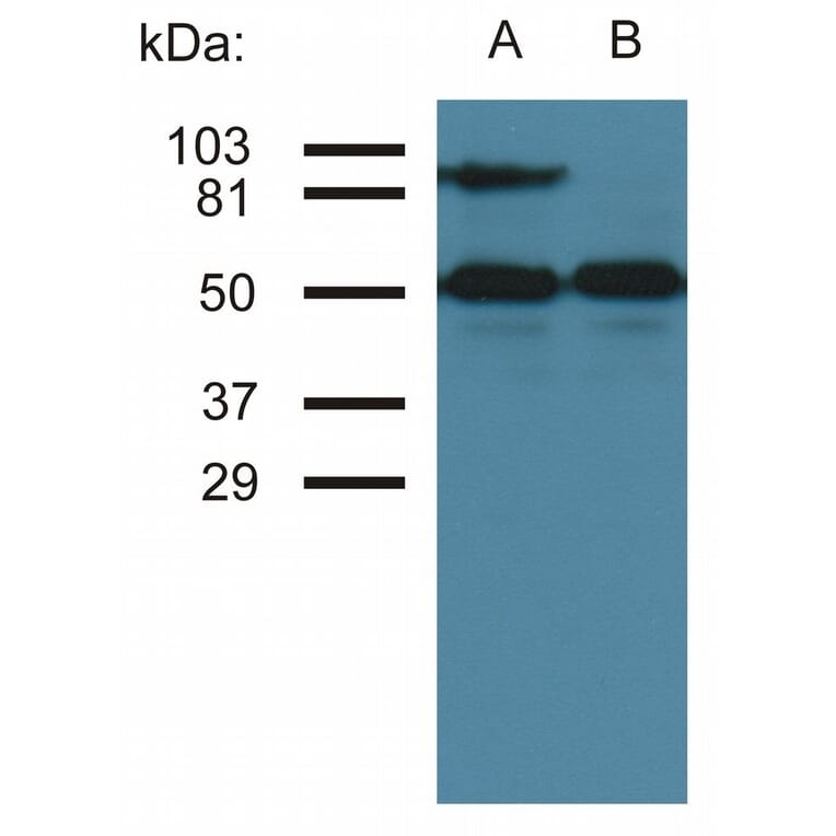 Western Blot - Anti-ICAM1 Antibody [MEM-111] (A85681) - Antibodies.com